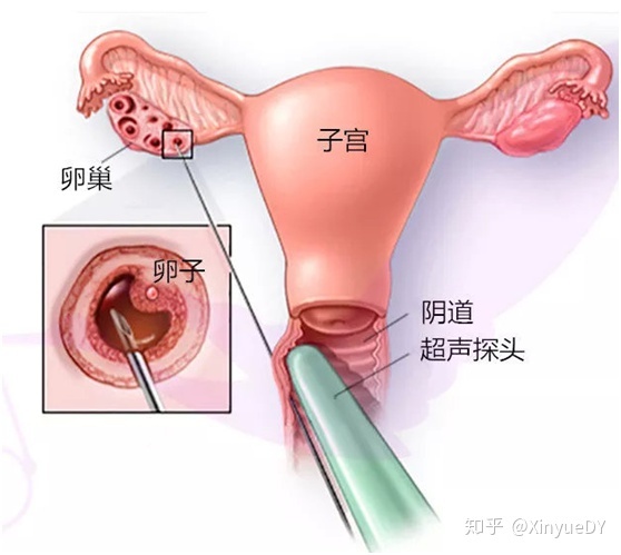 怀化妇幼做供卵试管婴儿谁的技术好？