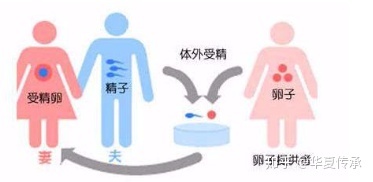 长沙供卵做试管双胞胎