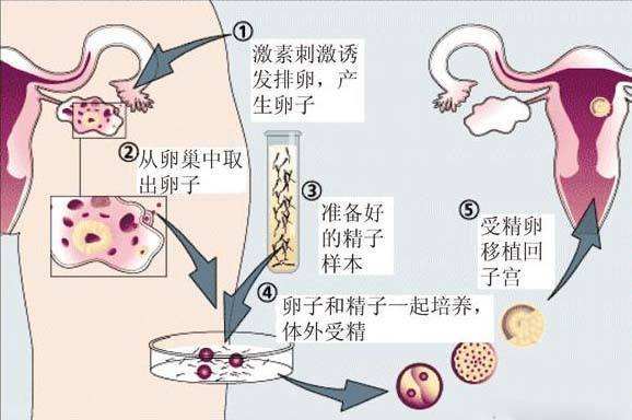 医院有做试管代怀没双胞胎成功率有多大